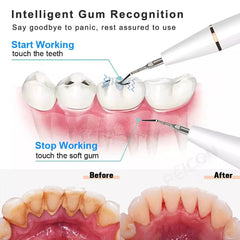 Electric Ultrasonic Dental Scaler for Stain and Tartar Removal