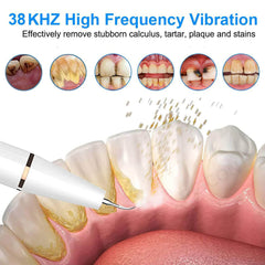 Electric Ultrasonic Dental Scaler for Stain and Tartar Removal