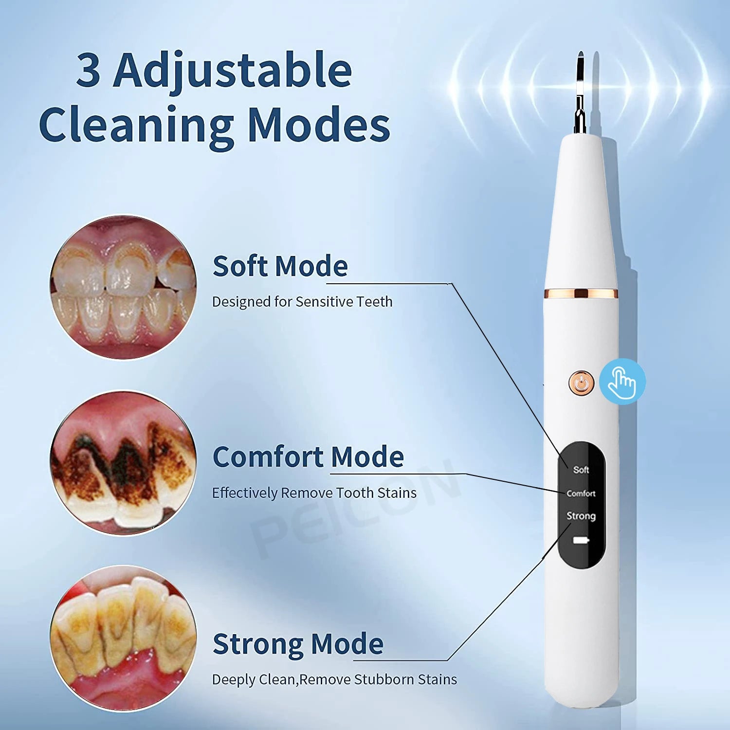 Electric Ultrasonic Dental Scaler: Stain and Tartar Removal