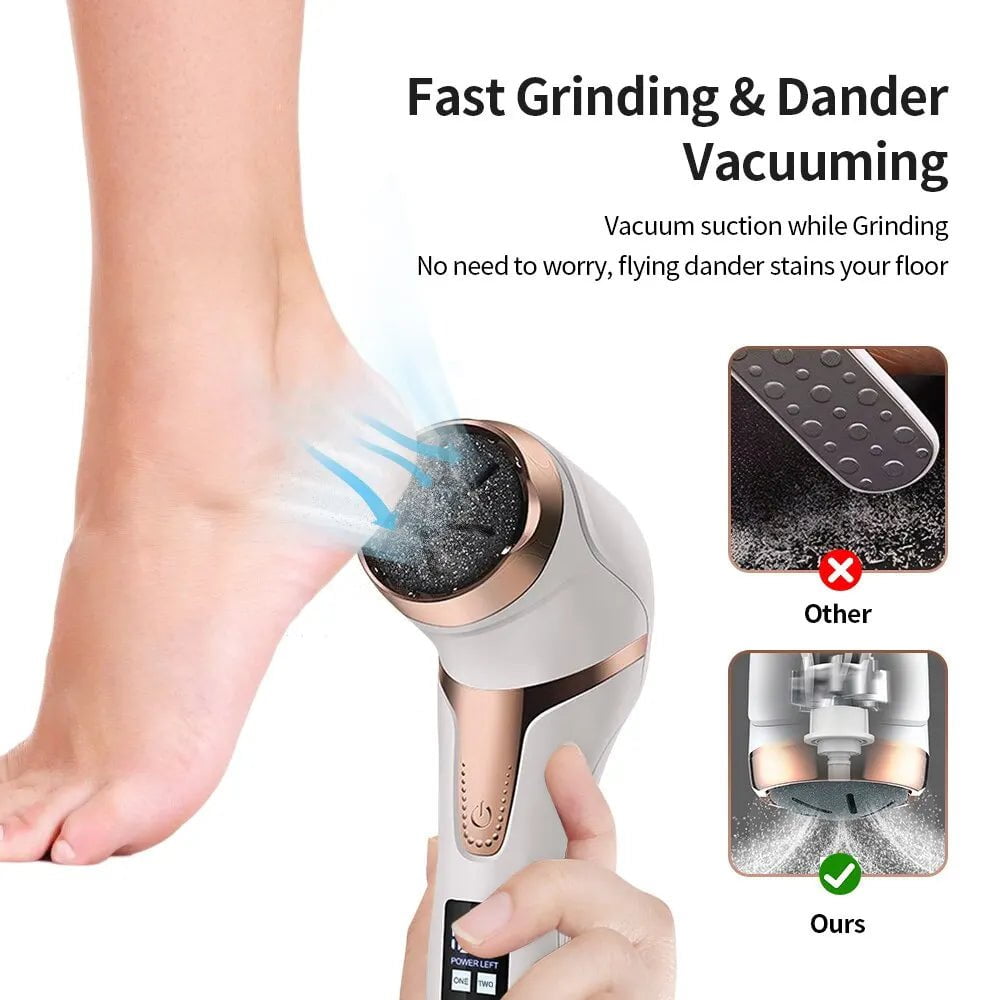 Portable Electric Foot Callus Remover: Rechargeable Pedicure Tool for Dead Hard Skin WHITE