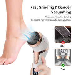 Portable Electric Foot Callus Remover: Rechargeable Pedicure Tool for Dead Hard Skin WHITE